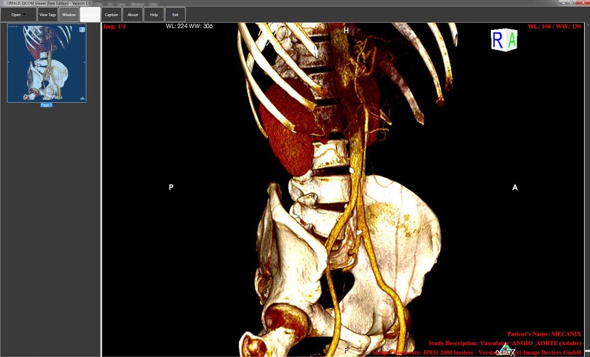 Radiant Dicom Viewer For Mac Free Download